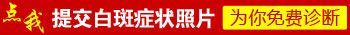 肢端型白癜风-哪些不良习惯能诱发肢端型白癜风